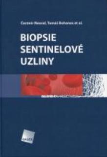 Biopsie sentinelové uzliny