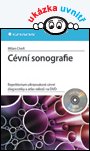 Cévní sonografie