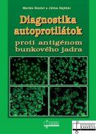 Diagnostika autoprotilátok proti antigénom bunkového jadra