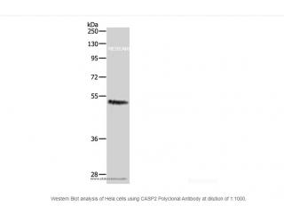 CASP2 Polyclonal Antibody Objem: 120 µL