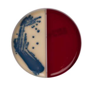 Columbia CNA Aesculin Selective Agar / Brilliance™ UTI