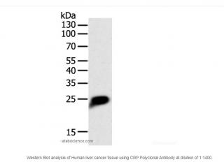 CRP Polyclonal Antibody Objem: 120 µL