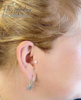 MICRODERMAL PIERCING