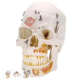 Deluxe Human Demonstration Dental Skull Model, 10 part (Anatomické modely)