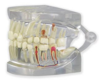 Jasný model ľudskej čeľuste so zubami (Anatomické modely)