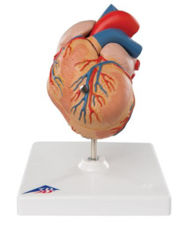 Klasické srdce s ľavou vertikulárnou  hypertrofiou (LVH), 2 časti (Anatomické modely)