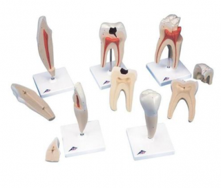 Klasický model zubov, 5 modelov (Anatomické modely)