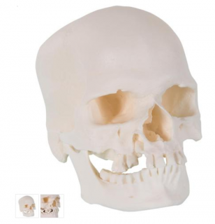 Microcephalic Human Skull Model (Anatomické modely)