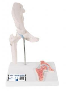 Mini model ľudského bedrového kĺbu s prierezom (Anatomické modely)