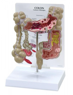 Model hrubého čreva (Anatomické modely)
