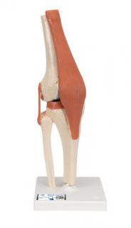 Model ľudského kolenného kĺbu s väzbami a označenou chrupavkou (Anatomické modely)