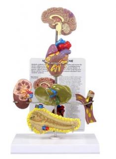 Model metabolického syndrómu  (Anatomické modely)