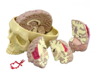 Model mozgu (Anatomické modely)