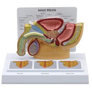 Model mužskej panvy s 3D prostatou (Anatomické modely)