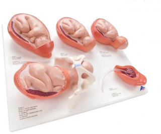 Model narodenia  (Anatomické modely)