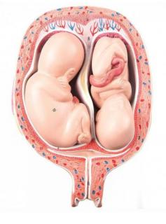 Model plodu dvojčiat, 5 mesiac, normálna poloha (Anatomické modely)