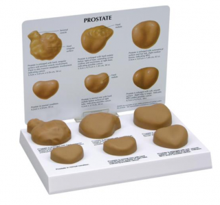 Model prostaty (Anatomické modely)