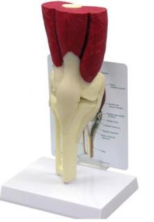 Model svalnatého kolena (Anatomické modely)