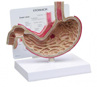 Model žalúdka s vredmi (Anatomické modely)