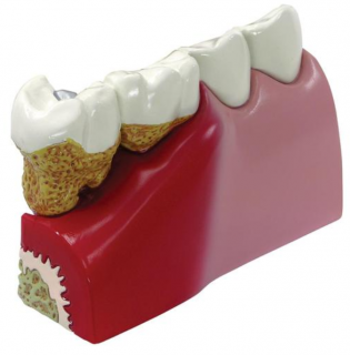 Model zubov (Anatomické modely)