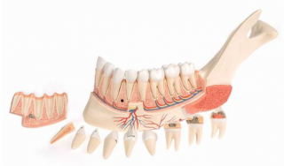 Pokročilá polovičná dolná čeľusť s 8 chorými zubami, 19 častí (Anatomické modely)