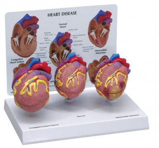 Súprava modelov 3-mini srdcia (Anatomické modely)