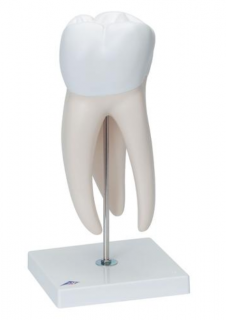 Veľká stolička s dentálnymi dutinami, 15-krát životná veľkosť, 6 dielov (Anatomické modely)