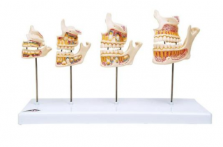 Vývoj chrupu (Anatomické modely)