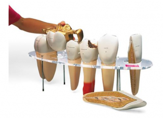 Zubná morfologická séria, 7 dielov, 10 krát životná veľkosť (Anatomické modely)