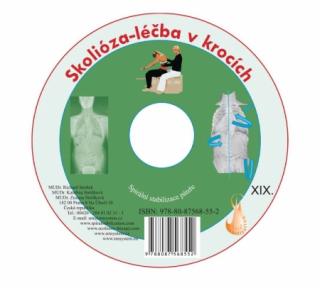 CD Skolióza - liečba v krokoch