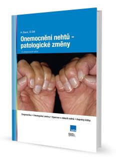 Kniha Ochorenie nechtov - patologické zmeny